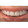 江苏专业整牙——优质的整牙