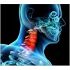 青岛颈椎病头晕治疗——山东口碑好的颈椎病中药治疗推荐